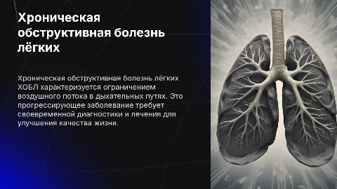 Хроническая обструктивная болезнь лёгких (ХОБЛ)