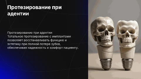 Тотальное протезирование при полной адентии с имплантами