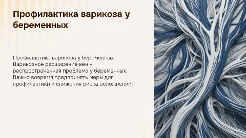 Профилактика варикозного расширения вен у беременных