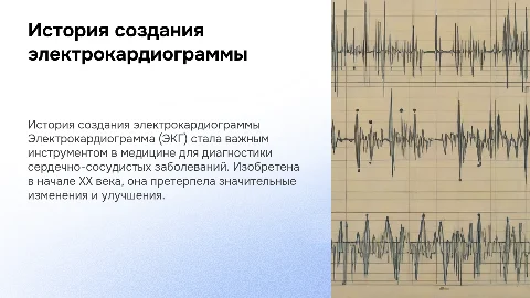 История создания электрокардиограммы