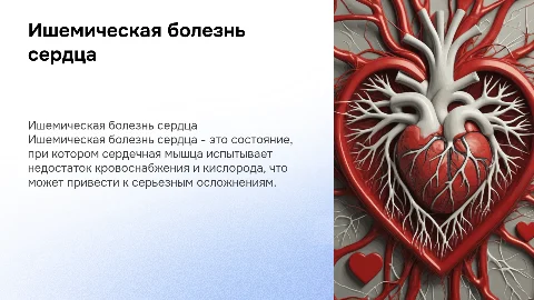 Ишемическая болезнь сердца