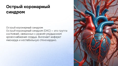 Презентация на тему ОКС: виды, лечение и примеры ЭКГ