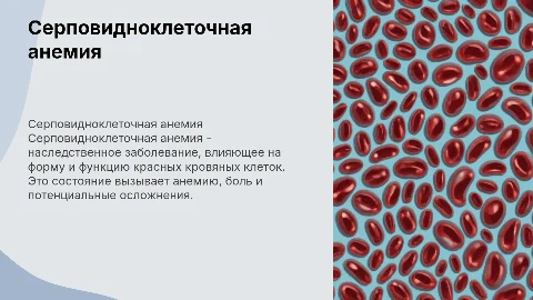 Серповидно клеточная анемия