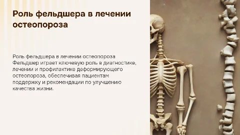 Деятельность фельдшера в лечении остеопороза: презентация
