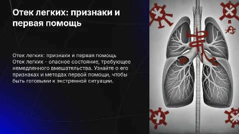 ОТЕК ЛЕГКИХ ХАРАКТЕРИСТИКА ПРИЗНАКИ ПМП