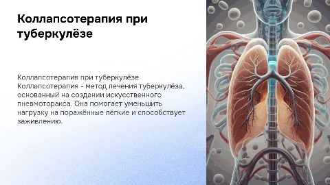 Коллапсотерапия при туберкулёзе. Методы лечения
