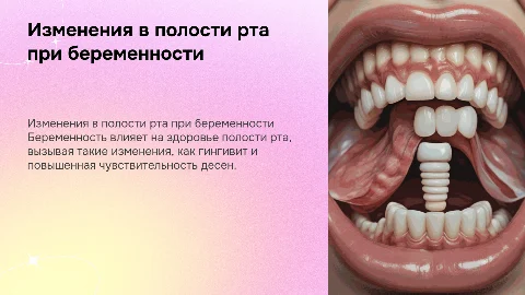Изменения в полости рта при беременности