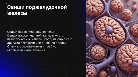 Свищи поджелудочной железы