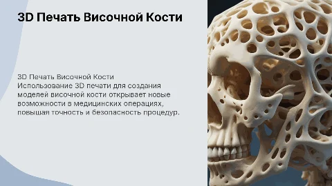 височная кость на 3D принтере для медицинских операций
