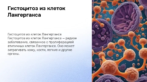 Гистоцитоз из клеток Лангерганса