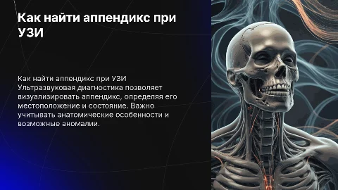как найти аппендикс при узи