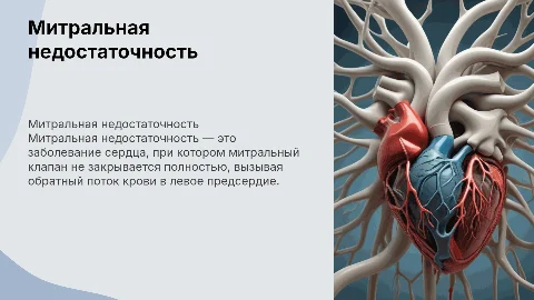 Митральная недостаточность