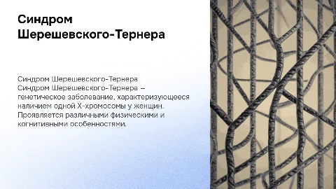 Синдром Шерешевского-Тернера: причины, признаки и прогноз
