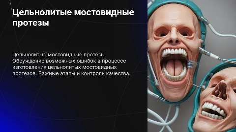 Цельнолитые мостовидные протезы: ошибки в изготовлении