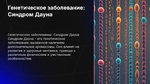 Генетическое заболевание Синдром дауна